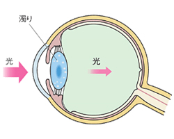 レンズについて(2)
